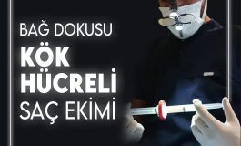 Türkiye’de Kök Hücreli Saç Ekimi Yapan En İyi Saç Ekimi Merkezi