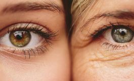 Uzmanından anti aging ve kalojen uyarısı: Çökersiniz