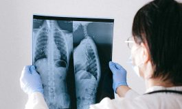 'Solunum yolu enfeksiyonları nedeniyle yoğun bakımlarda artış var'