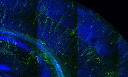 Beyni Yeniden İnşa Etmek: Sinir Sistemi Araştırmalarında Hibrit Beyinler ve Etik Sorunlar!