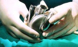 Titanyumdan Yapılmış Yapay Kalp Başarıyla Nakledildi!