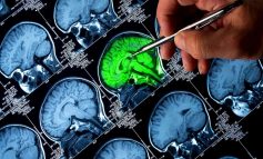 Alzheimer hastalığının 10 erken sinyali nelerdir?