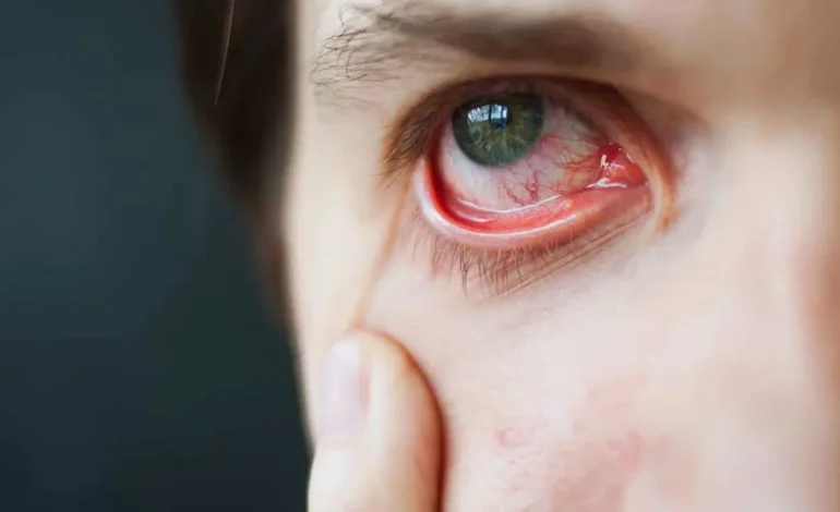 Ekrana bu kadar bakmayı bırakmanız gerekiyor!