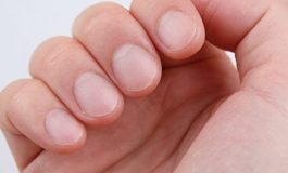 Tırnaklarda 8 önemli hastalık sinyali!