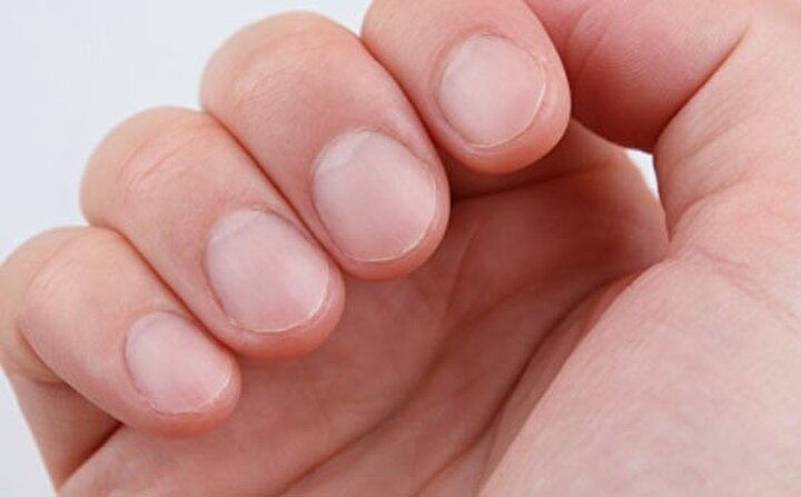 Tırnaklarda 8 önemli hastalık sinyali!