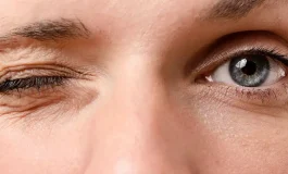 Göz seğirmesi ne zaman ciddiye alınmalı?