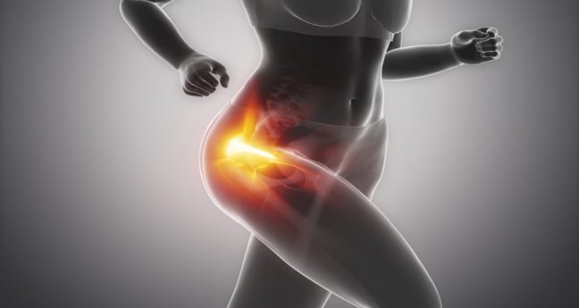 Kalça kireçlenmesi (osteoartrit) nedir? Tedavisi nasıldır?