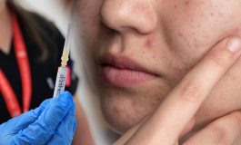 Dünya tarihinde bir ilk: 'Sivilce aşısı' geliştiriliyor