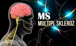 MS (Multipl Skleroz) hakkında bilinmesi gereken 9 önemli nokta