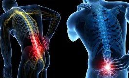 Omurilik darlığı: Ameliyat edilmezse felce kadar ilerliyor!